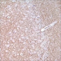 Антитело мышиное моноклональное Neurofilament (2F11)