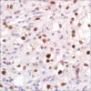 Антитело моноклональное кроличье PAX-2 (EP235), первичное