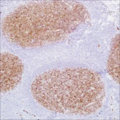 Антитело моноклональное мышиное CD10 (56C6)