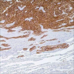 Антитело мышиное моноклональное CD56 (123C3.D5)