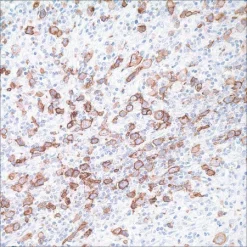 Моноклональное антитело мыши CD30 (Ber-H2)