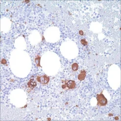 Моноклональное антитело мыши CD61 (2f2)