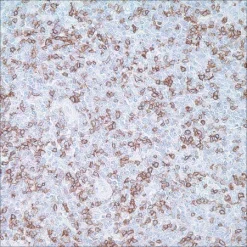 Антитело моноклональное мышиное CD5 (4C7)