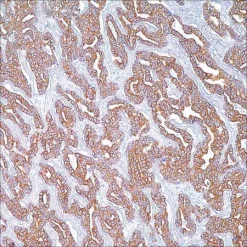 Цитокератиновый коктейль (AE1 и AE3), мышиные моноклональные антитела