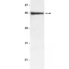 Антитело к бычьему сывороточному альбумину (BSA), кроличье, Upstate®