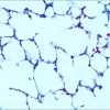 Контрольные слайды TISSUE-TROL™ для кислотоустойчивых бактерий, ткань легкого мыши с Mycobacterium gordonae
