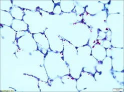 Контрольные слайды TISSUE-TROL™ для кислотоустойчивых бактерий, ткань легкого мыши с Mycobacterium gordonae