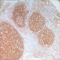 Антитело моноклональное мышиное CD19 (MRQ-36)