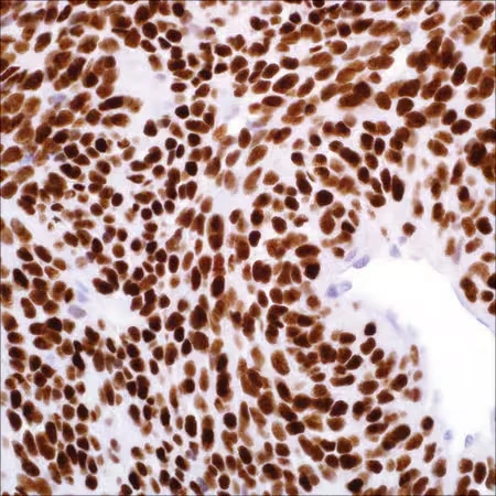 Моноклональное антитело мыши TLE1 (1F5)